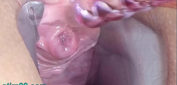  Pee Hole Play Sounding with Catheter and Dildo Penetration